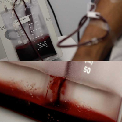 Blood Equality