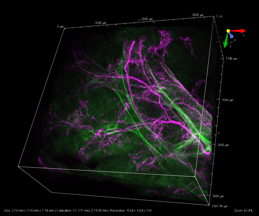 Mouse Lung 3D