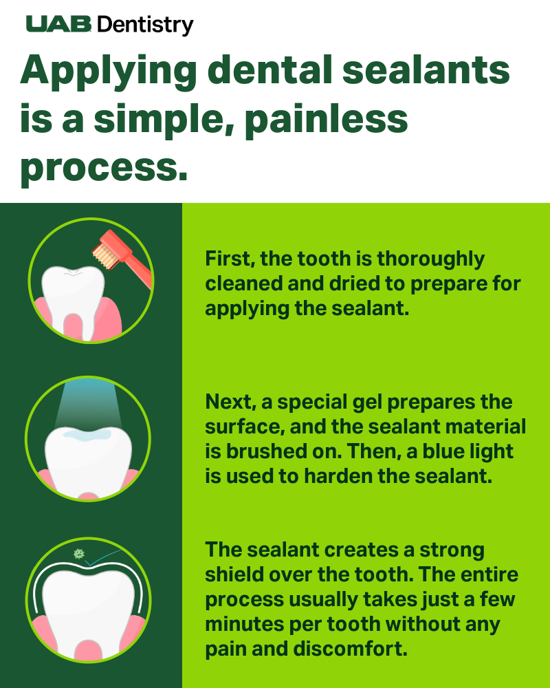 dental sealants infographic