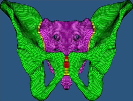 Human pelvis finite element model. 