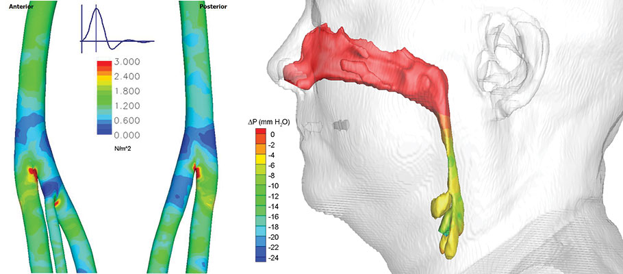 Model of nasal passages.