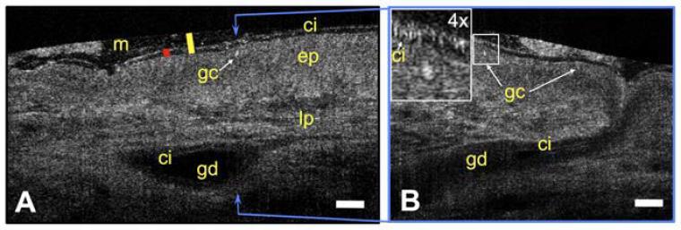 OCTFunctionalAnatomyofHumanTrachea