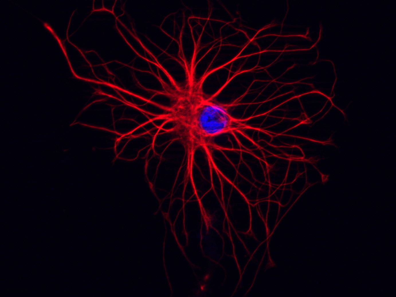 astrocyte