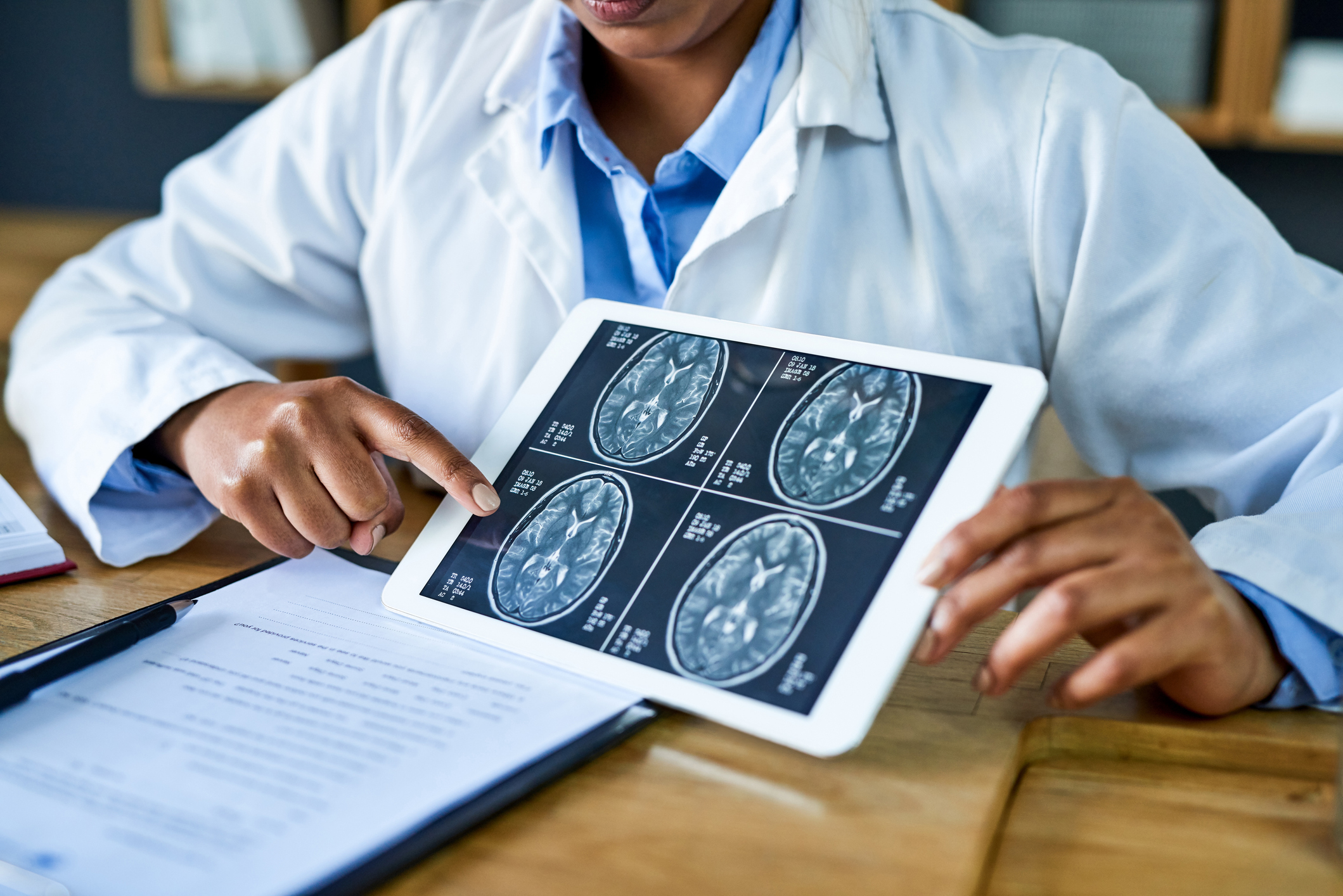 neuro stock image