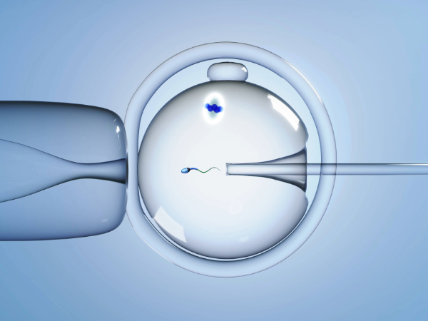 In vitro fertilization. Sperm injection using the piezo device. The spindle of the egg is visualized.