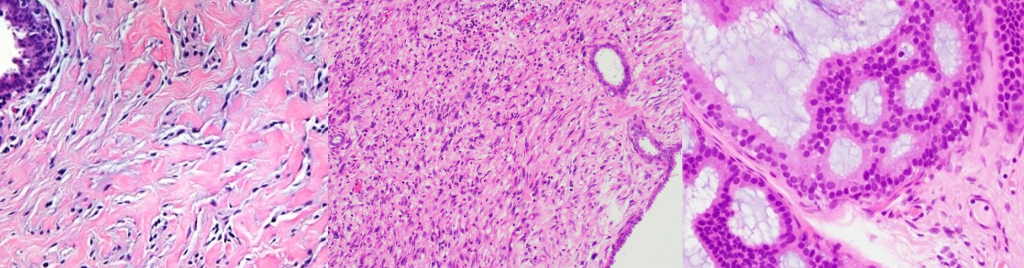 Diagnostic_Breast_.png
