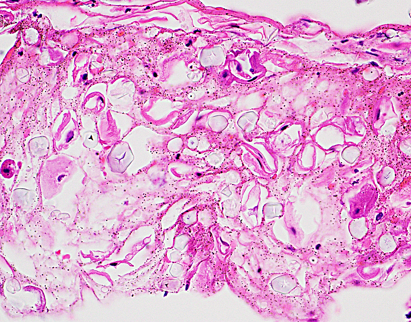 Fig. B High Magnification x40