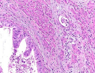 Gyn_fellowship_3.jpg