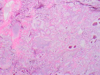 Listeriosis_Picture_1_COTW_4.21.jpg