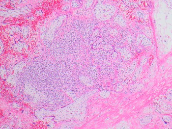 Listeriosis_Picture_2_COTW_4.21.jpg