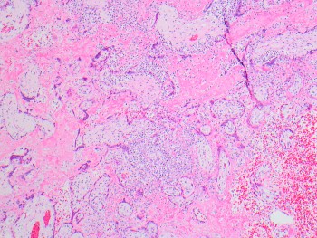 Listeriosis_Picture_3_COTW_4.21.jpg