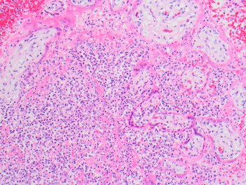 Listeriosis_Picture_4_COTW_4.21.jpg