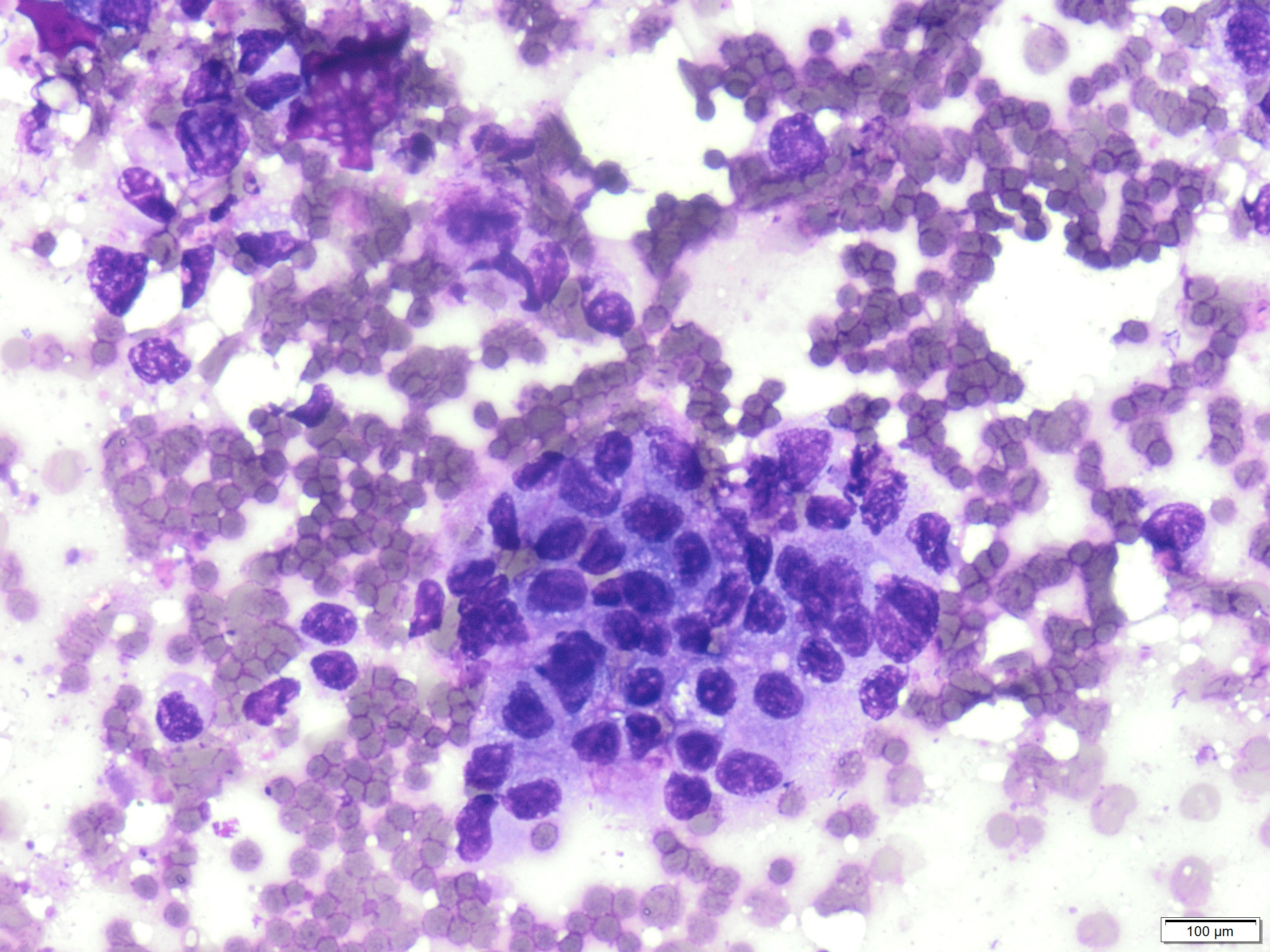 diff quik stained smear x40