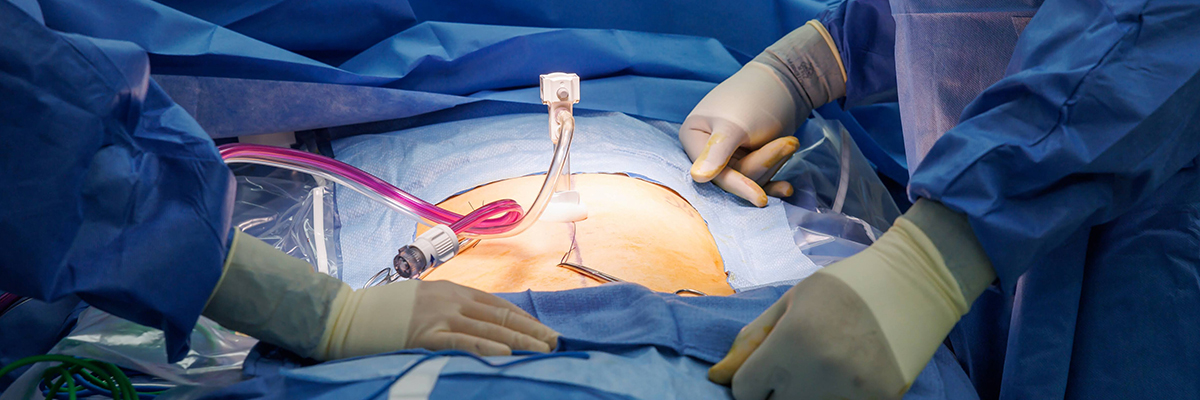 oncology section header