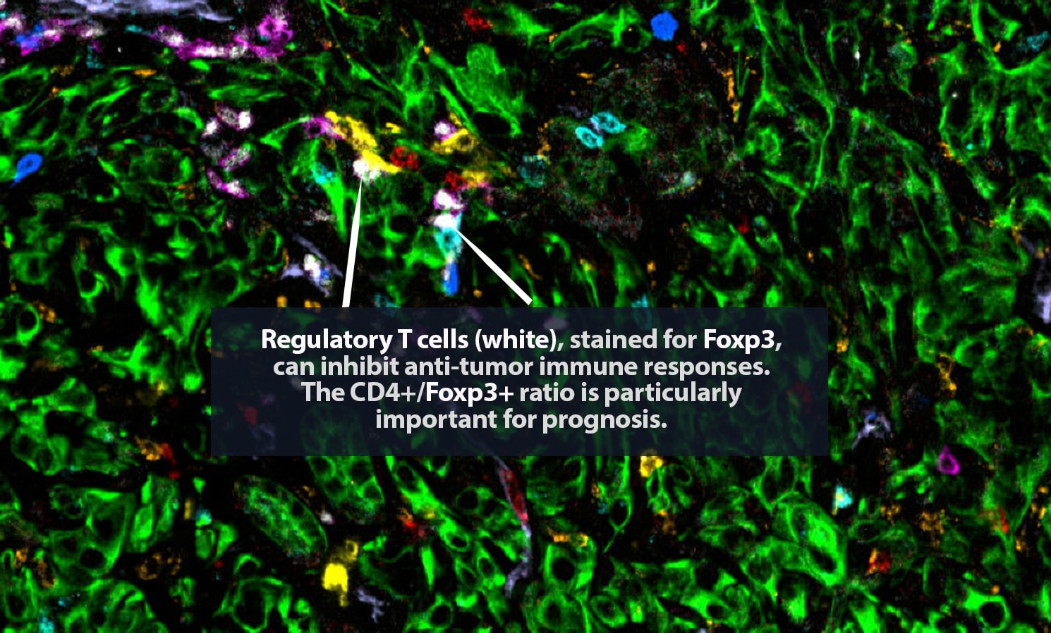 5 alt white immune 1490x898px