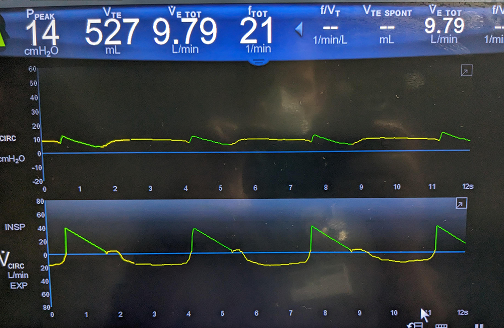 rep severe flow starvation 1000px