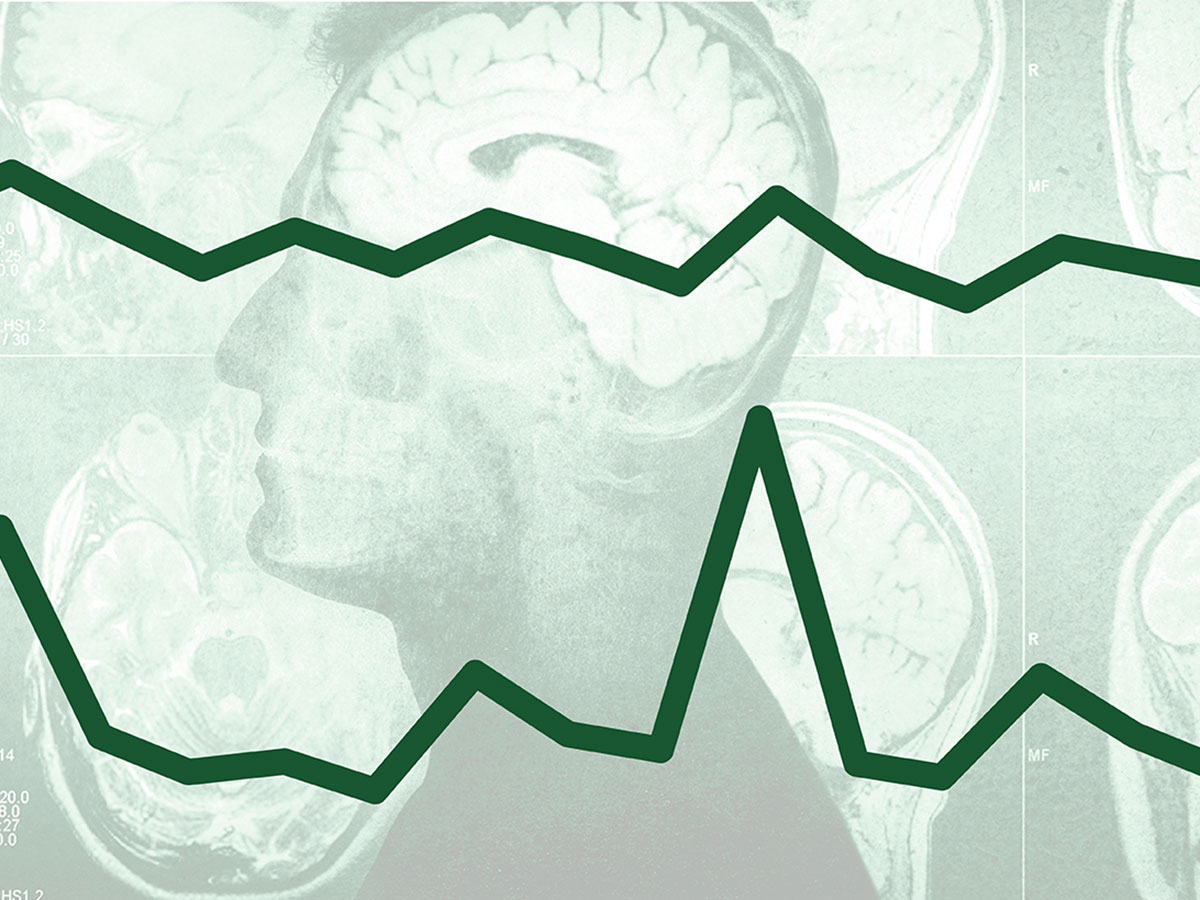 An illustration of a brain scan superimposed on a man in profile is seen behind two time series lines - the one on top has low peaks and represents average or normal scores the one below has jagged peaks and represents abnormal